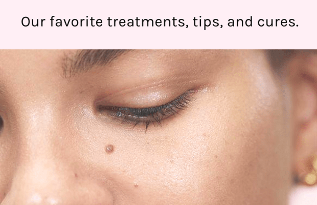 A Step-by-Step Guide to Dealing with Skin Breakouts